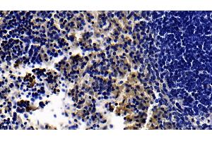 Detection of TLR5 in Mouse Spleen Tissue using Polyclonal Antibody to Toll Like Receptor 5 (TLR5) (TLR5 antibody  (AA 693-858))