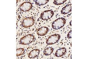 Immunohistochemistry (Paraffin-embedded Sections) (IHC (p)) image for anti-Paired Box Gene 2a (PAX2A) antibody (ABIN7074974)