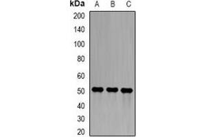 Western blot analysis of Epsilon-sarcoglycan expression in A549 (A), ES2 (B), mouse lung (C) whole cell lysates. (SGCE antibody)