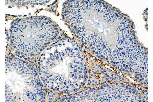 ABIN6258677 and ABIN6274898 at 1/100 staining Mouse testis tissue by IHC-P. (BNIP2 antibody  (Internal Region))