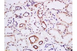 Formalin-fixed and paraffin embedded human kidney labeled with Anti-DTX3L Polyclonal Antibody, Unconjugated  at 1:200 followed by conjugation to the secondary antibody and DAB staining. (DTX3L antibody  (AA 651-740))