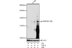 Western blot analysis of extracts of various cell lines, using Phospho-MK5-S83 antibody (ABIN3019487, ABIN3019488, ABIN3019489 and ABIN6225424) at 1:1000 dilution. (ASK1 antibody  (pSer83))
