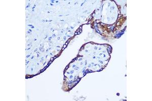 Immunohistochemistry of paraffin-embedded human placenta using RhoA Rabbit pAb (ABIN3020848, ABIN3020849, ABIN3020850 and ABIN6213755) at dilution of 1:100 (40x lens).