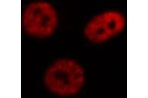 ABIN6269111 staining Hep G2 cells by IF/ICC.