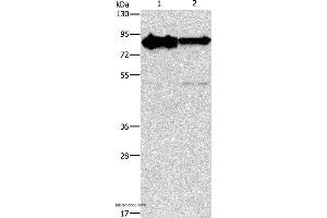Western blot analysis of Mouse brain and human brain malignant glioma tissue, using KIF3A Polyclonal Antibody at dilution of 1:750 (KIF3A antibody)
