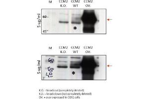 Western Blot Analysis of anti-human CCM-2. (CCM2 antibody  (N-Term))
