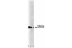 Western blot analysis of Cofilin on mouse cerebrum lysate. (Cofilin antibody  (AA 3-98))