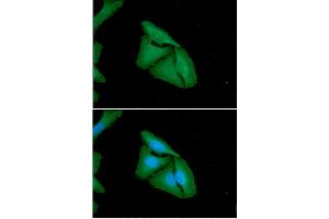 ICC/IF analysis of FHL2 in HeLa cells. (FHL2 antibody)