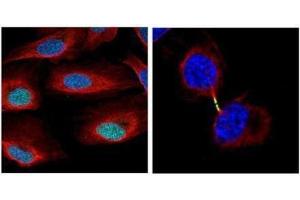 ICC/IF Image Confocal immunofluorescence analysis (Olympus FV10i) of paraformaldehyde-fixed U2OS, using Survivin, antibody (Geen) at 1:500 dilution. (Survivin antibody)
