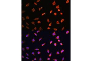 Immunofluorescence analysis of L929 cells using  antibody (ABIN6129884, ABIN6137152, ABIN6137153 and ABIN6214229) at dilution of 1:100. (ART1 antibody  (AA 23-295))