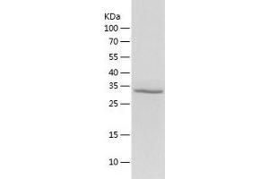 Western Blotting (WB) image for Aminoadipate-Semialdehyde Dehydrogenase-phosphopantetheinyl Transferase (AASDHPPT) (AA 14-309) protein (His tag) (ABIN7121812) (AASDHPPT Protein (AA 14-309) (His tag))