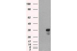 HEK293T cells were transfected with the pCMV6-ENTRY control (Left lane) or pCMV6-ENTRY CD2 (Right lane) cDNA for 48 hrs and lysed. (CD2 antibody)