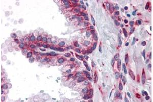 Human Prostate: Formalin-Fixed, Paraffin-Embedded (FFPE) (MTDH antibody)