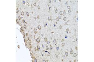 Immunohistochemistry of paraffin-embedded mouse brain using HBA2 antibody at dilution of 1:100 (x40 lens). (HBa2 antibody)