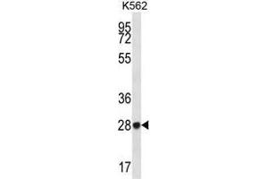 ZNF146 Antibody (N-term) western blot analysis in K562 cell line lysates (35 µg/lane). (ZNF146 antibody  (N-Term))