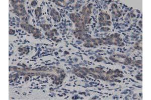 Immunohistochemistry (IHC) image for anti-DnaJ (Hsp40) Homolog, Subfamily A, Member 2 (DNAJA2) antibody (ABIN1497862) (DNAJA2 antibody)