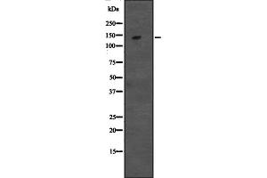 Western blot analysis of CCAR1 expression in Hela cell lysate,The lane on the left is treated with the antigen-specific peptide.