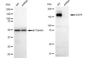 Western blotting analysis using EGFR antibody (ABIN7798461). (Recombinant EGFR antibody)