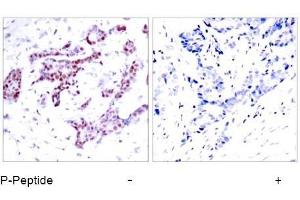 Image no. 1 for anti-Signal Transducer and Activator of Transcription 1, 91kDa (STAT1) (pTyr701) antibody (ABIN196688) (STAT1 antibody  (pTyr701))