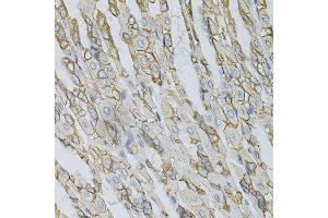 Immunohistochemistry (Paraffin-embedded Sections) (IHC (p)) image for anti-Adaptor-Related Protein Complex 2, beta 1 Subunit (AP2B1) (AA 752-951) antibody (ABIN3015810)