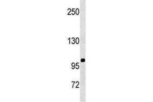 CD43 antibody western blot analysis in SK-BR-3 lysate. (CD43 antibody  (AA 230-257))