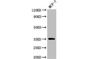 Western Blot Positive WB detected in: MCF-7 whole cell lysate All lanes: ACY3 antibody at 3 μg/mL Secondary Goat polyclonal to rabbit IgG at 1/50000 dilution Predicted band size: 36 kDa Observed band size: 36 kDa (Aminoacylase 3 antibody  (AA 5-319))
