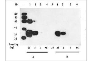 Lane 1-3: 25 ng, 5 ng, 1 ng GST fusion protein. (GST antibody)