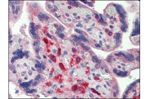 Immunohistochemistry (Paraffin-embedded Sections) (IHC (p)) image for anti-V-Yes-1 Yamaguchi Sarcoma Viral Oncogene Homolog 1 (YES1) antibody (ABIN615523)