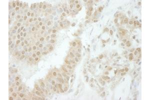 Immunohistochemistry (IHC) image for anti-TIP41-like protein (TIPRL) (C-Term) antibody (ABIN7448836)