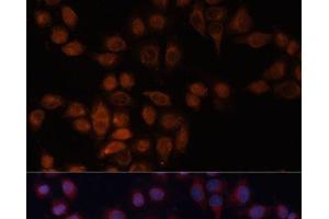 Immunofluorescence analysis of HeLa cells using ADAM15 Polyclonal Antibody at dilution of 1:100 (40x lens). (ADAM15 antibody)