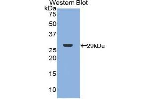 Detection of Recombinant NF2, Human using Polyclonal Antibody to Neurofibromin 2 (NF2) (Merlin antibody  (AA 30-239))