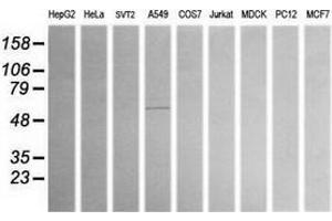 Western Blotting (WB) image for anti-Aldehyde Dehydrogenase 1 Family, Member A3 (ALDH1A3) (AA 1-100), (AA 413-512) antibody (ABIN2715887) (ALDH1A3 antibody  (AA 1-100, AA 413-512))