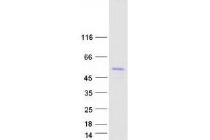 Western Blotting (WB) image for Transforming Growth Factor beta 1 Induced Transcript 1 (TGFB1I1) (Transcript Variant 3) protein (Myc-DYKDDDDK Tag) (ABIN2733512)