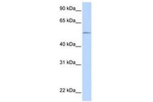Image no. 1 for anti-UDP Glucuronosyltransferase 1 Family, Polypeptide A1 (UGT1A1) (AA 36-85) antibody (ABIN6740865) (UGT1A1 antibody  (AA 36-85))
