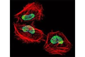 Fluorescent confocal image of HeLa cell stained with HDAC4 antibody at 1:25. (HDAC4 antibody  (AA 1049-1077))