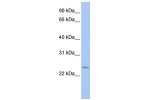 PRELID2 antibody used at 1 ug/ml to detect target protein. (PRELID2 antibody  (C-Term))