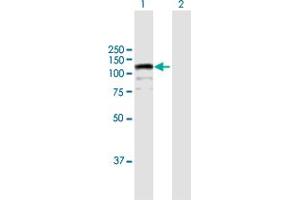 Western Blot analysis of CIZ1 expression in transfected 293T cell line by CIZ1 MaxPab polyclonal antibody. (CIZ1 antibody  (AA 1-818))