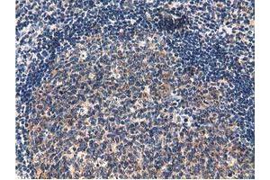 Immunohistochemical staining of paraffin-embedded Human lymph node tissue using anti-CBWD1 mouse monoclonal antibody. (CBWD1 antibody)