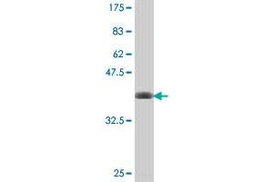 Western Blot detection against Immunogen (38. (Clathrin Heavy Chain (CLTC) (AA 232-340) antibody)