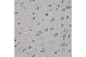 Immunohistochemistry of paraffin-embedded rat brain using HMMR antibody (ABIN5971368) at dilution of 1/100 (40x lens). (HMMR antibody)
