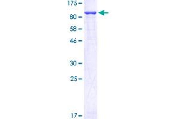 GFPT1 Protein (AA 1-681) (GST tag)