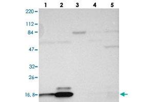 Western blot analysis of Lane 1: RT-4, Lane 2: U-251 MG, Lane 3: Human Plasma, Lane 4: Liver, Lane 5: Tonsil with RPL27 polyclonal antibody .