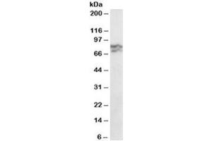 Western blot testing of HeLa lysate with RPA70 antibody at 0. (RPA1 antibody)