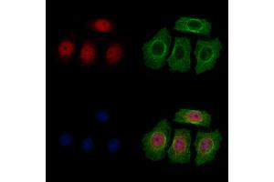 ABIN7094464 and ABIN7098512 staining HepG2 cells by IF/ICC.