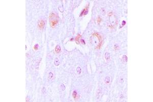 Immunohistochemical analysis of Tyrosine Hydroxylase staining in human brain formalin fixed paraffin embedded tissue section. (Tyrosine Hydroxylase antibody  (N-Term))