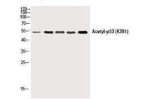 Western Blotting (WB) image for anti-Tumor Protein P53 (TP53) (acLys381) antibody (ABIN7251004)