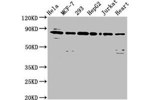 Western Blot Positive WB detected in: Hela whole cell lysate, MCF-7 whole cell lysate, 293 whole cell lysate, HepG2 whole cell lysate, Jurkat whole cell lysate, Mouse heart tissue All lanes: LETM1 antibody at 6. (LETM1 antibody  (AA 443-543))