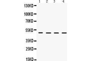 Western Blotting (WB) image for anti-Lecithin-Cholesterol Acyltransferase (LCAT) (AA 389-423), (C-Term) antibody (ABIN3043289) (LCAT antibody  (C-Term))