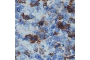Immunohistochemical analysis of CD32b staining in human lymph node formalin fixed paraffin embedded tissue section.