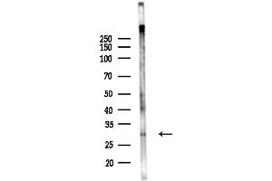 anti-Major Histocompatibility Complex, Class II, DR beta 3 (HLA-DRB3) (Internal Region) antibody